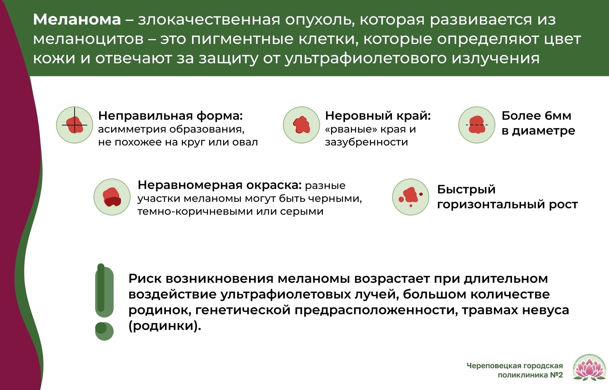 Меланома кожи (Меланобластома) — причины возникновения, симптомы, диагностика, лечение в Москве